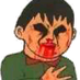 EggPain
